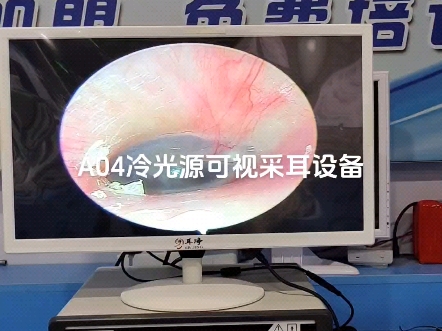 设备专业掏耳仪器可视掏耳设备采耳店可视镜采耳机器可视采耳可视耳镜