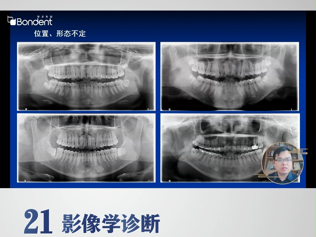 21-骨岛-影像学诊断