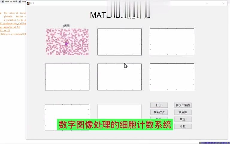 基于MATLAB的细胞计数系统GUI设计带界面设计(界面)哔哩哔哩bilibili