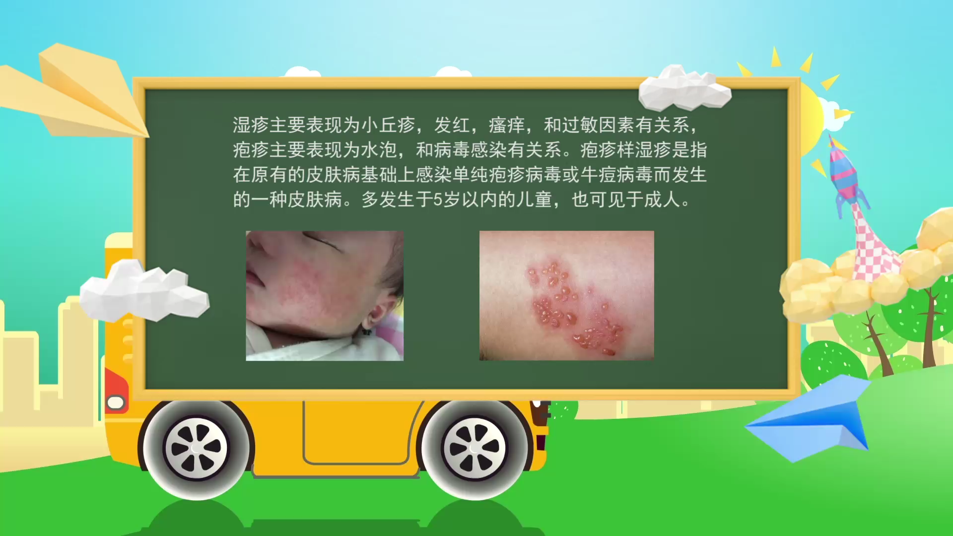 杏璞霜:宝宝湿疹与疱疹性湿疹有什么不同?