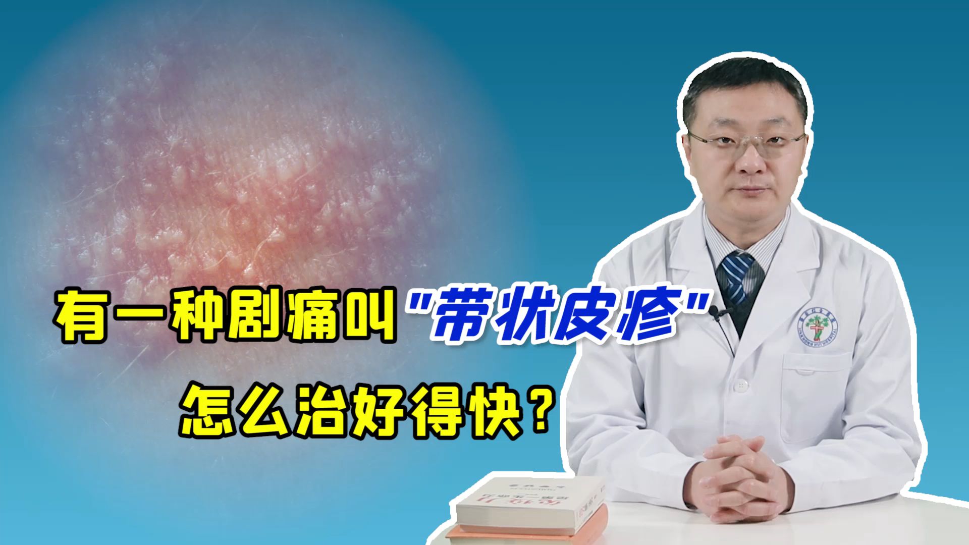 有一种剧痛叫"带状疱疹",该怎么治?这4个方法即可快速治疗!哔哩哔哩bilibili