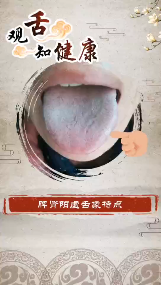 脾肾阳虚的舌象,仙方谷和你一起看看哔哩哔哩bilibili