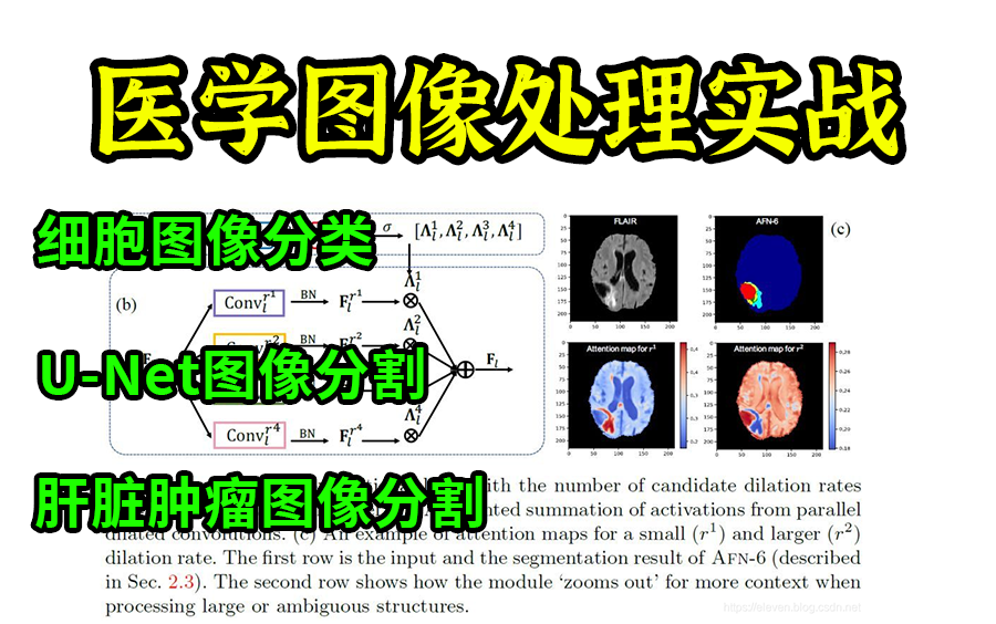 【医学图像处理实战教程】计算机博士精讲肝脏肿瘤图像分割、细胞图像分类、UNet医学图像分割实战,学不会你来找我!计算机视觉/unet图像分割哔哩哔...