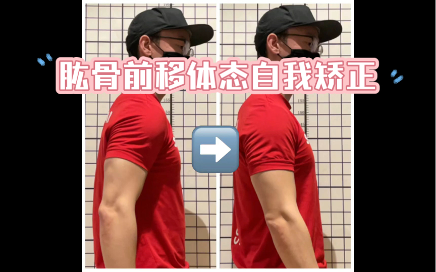 【肱骨前移】体态自我矫正教学视频