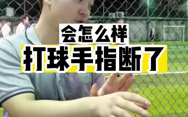 打球手指断了会怎么样哔哩哔哩bilibili