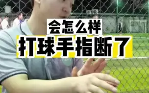 Tải video: 打球手指断了会怎么样