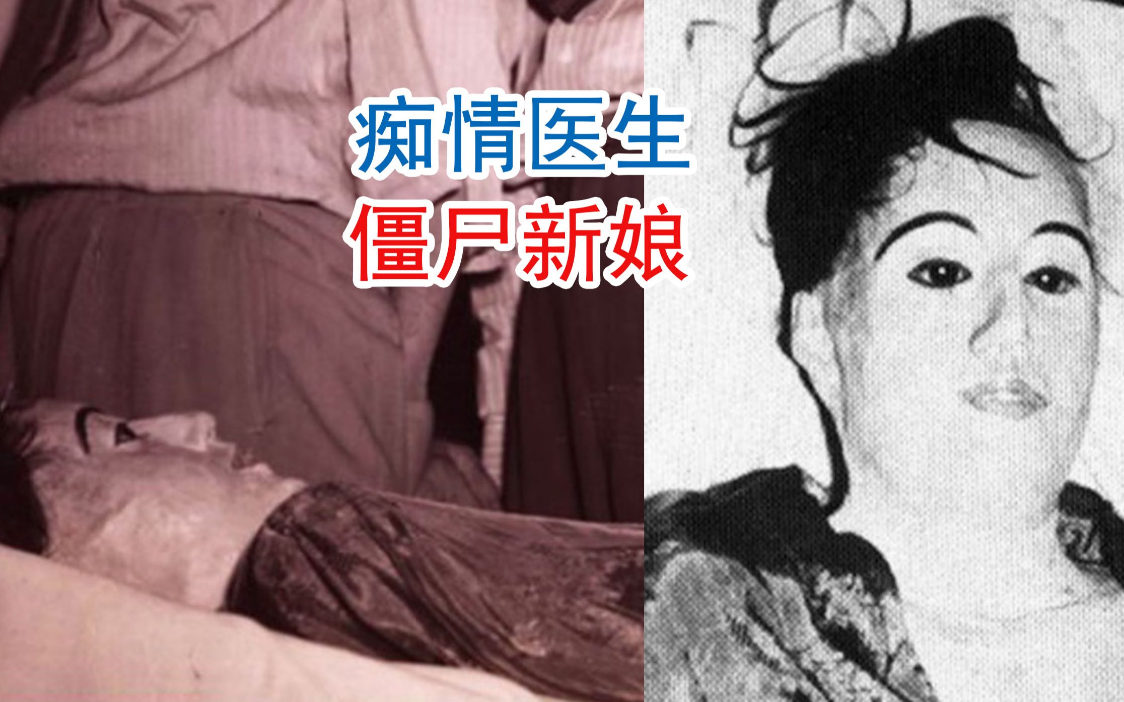 死了都要爱痴情医生和他的僵尸新娘