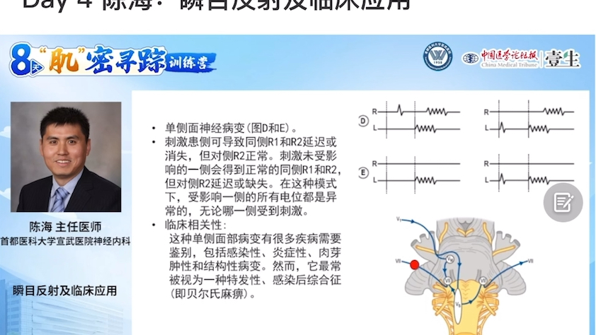 自录存档:8天“肌”密寻踪之瞬目反射哔哩哔哩bilibili