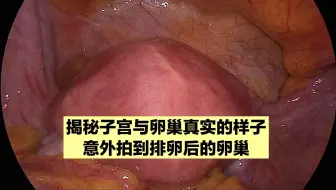 来看孕育生命的地方，真实的子宫和卵巢，可能跟你想象的很不一样