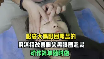 Download Video: 眼袋大黑眼圈明显的，用这招改善眼袋黑眼圈超灵，动作简单随时做！郭占青日式小颜术！