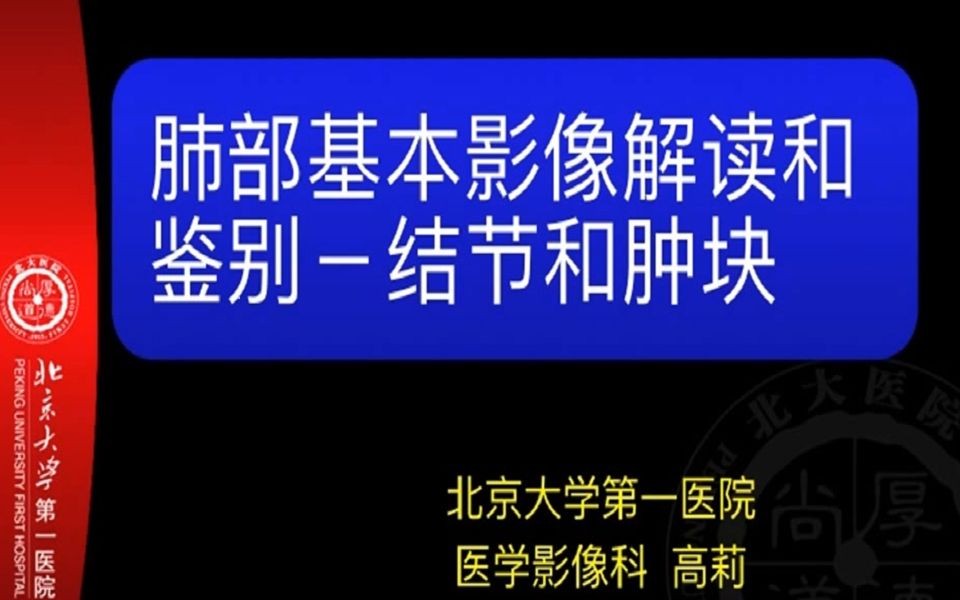 肺部影像学基本概念及影像学鉴别结节与肿块哔哩哔哩bilibili