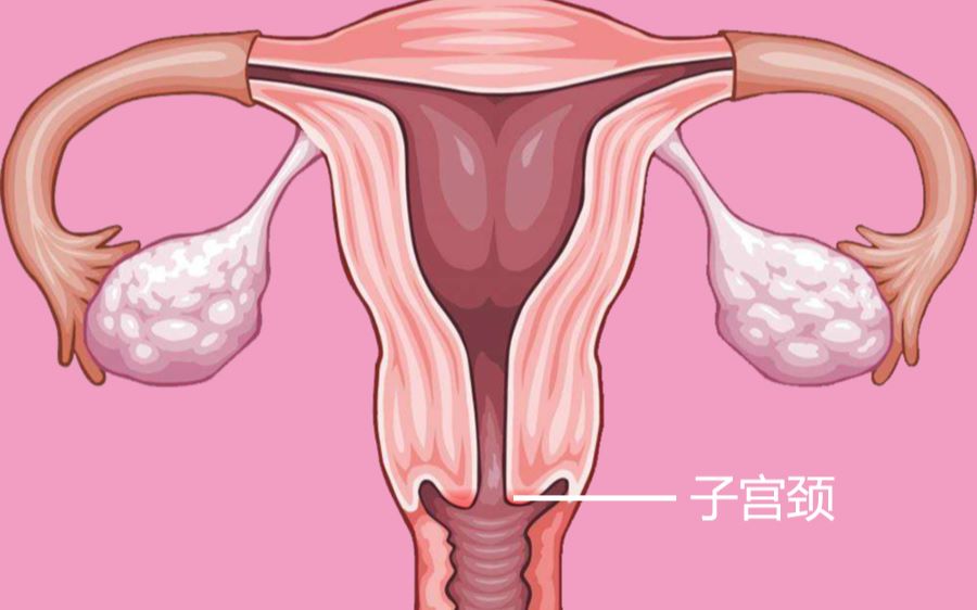 【飞碟一分钟】宫颈糜烂?是哪里坏掉了?哔哩哔哩bilibili