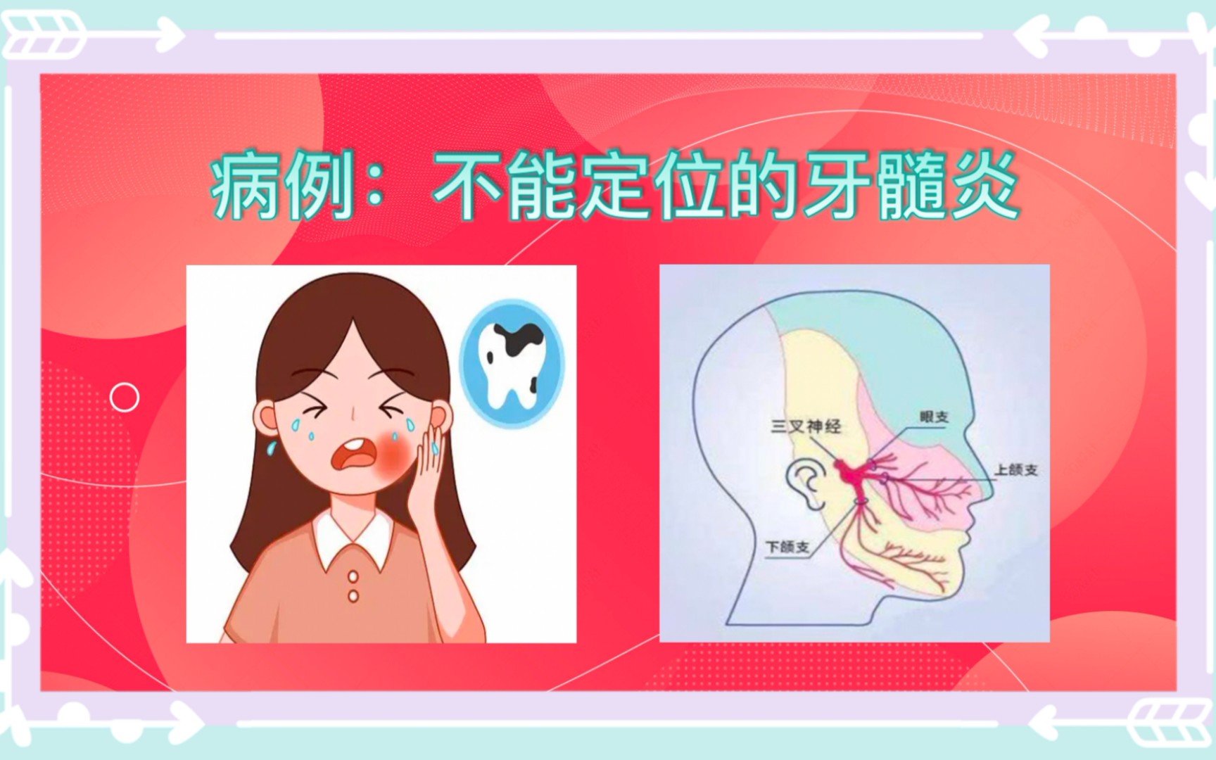 [牙体牙髓] 病例分享:不能自行定位的急性牙髓炎哔哩哔哩bilibili