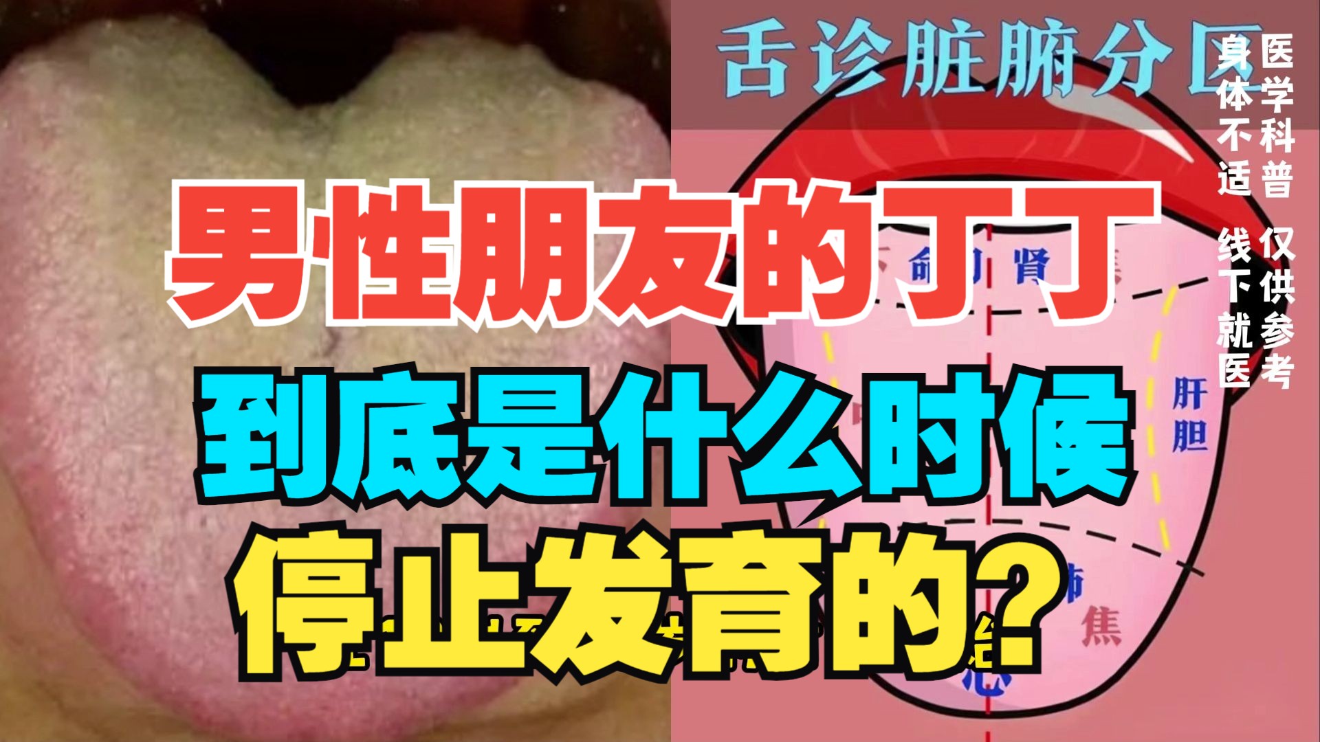 男性朋友的丁丁,到底是什么时候,停止发育的?哔哩哔哩bilibili