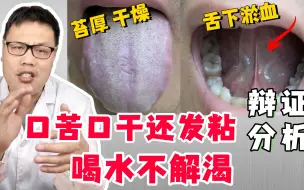 Download Video: 口苦口干还发粘，喝水不解渴，中医分析：清热除湿，活血化瘀！