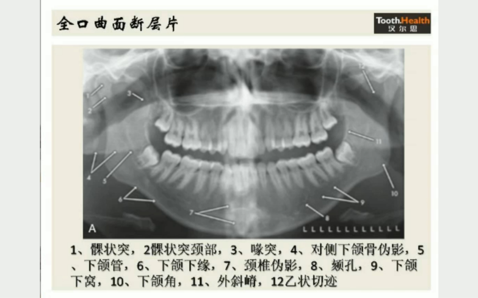 [图]从零开始学读片（第五节口腔外科与影像学）