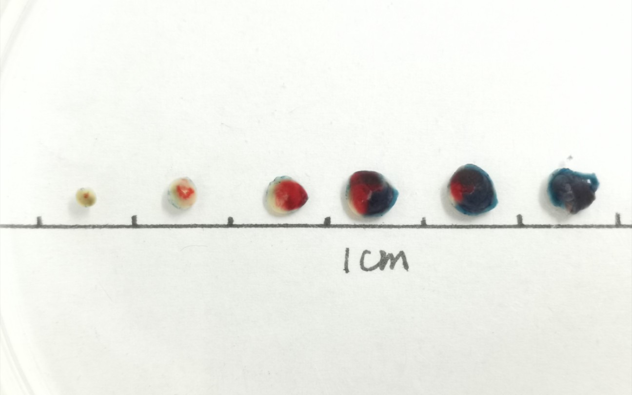 小鼠心肌梗死造模切片染色ttc