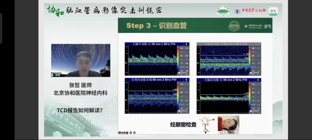 经典系列0025TCD血管判读哔哩哔哩bilibili