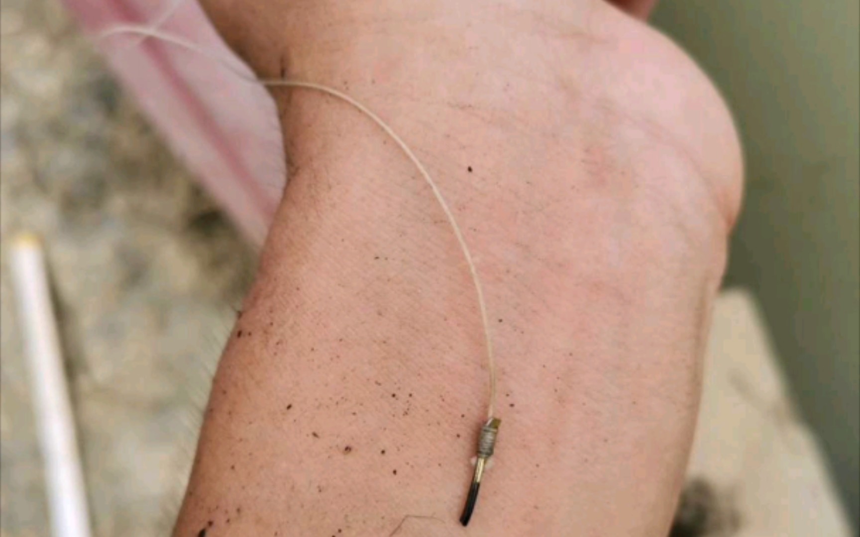 鱼没钓到,钩子扎手上了