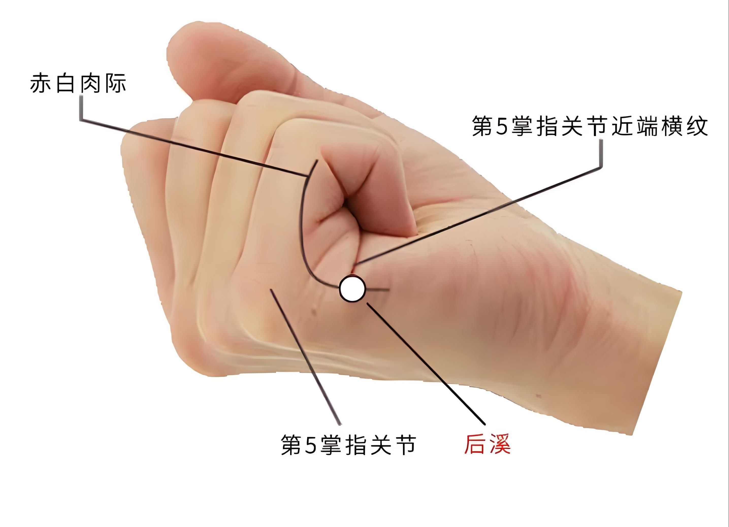 77,手太阳小肠经 — 后溪穴 — 颈项腰背痛