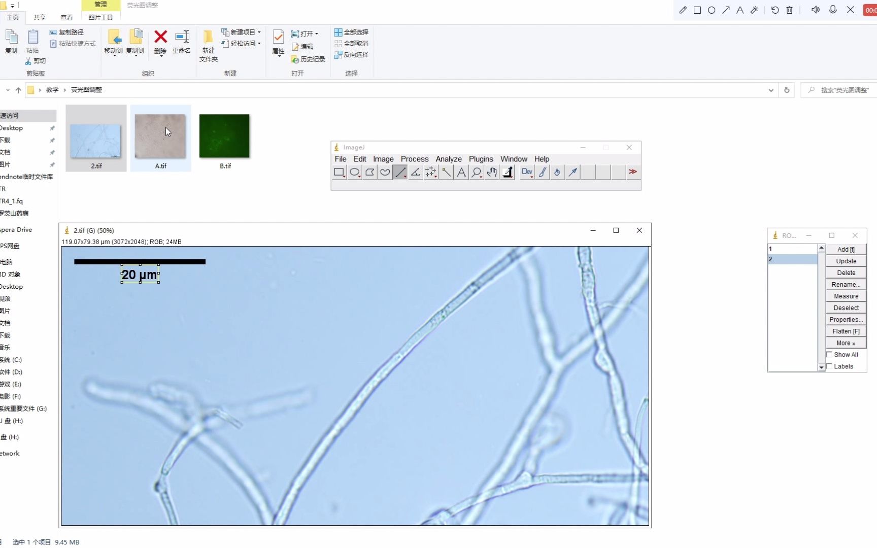 【保姆级教程】【科研必备】如何用imageJ批量给图片加标尺哔哩哔哩bilibili