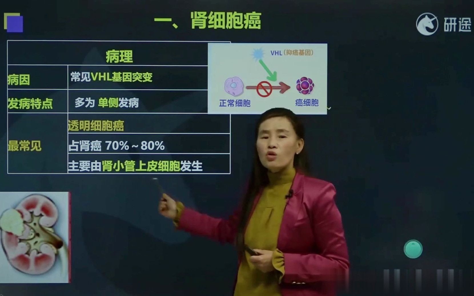 2022考研西医综合全程班研途考研外科第四章泌尿外科(七)泌尿、男生殖系统肿瘤(最新版)哔哩哔哩bilibili