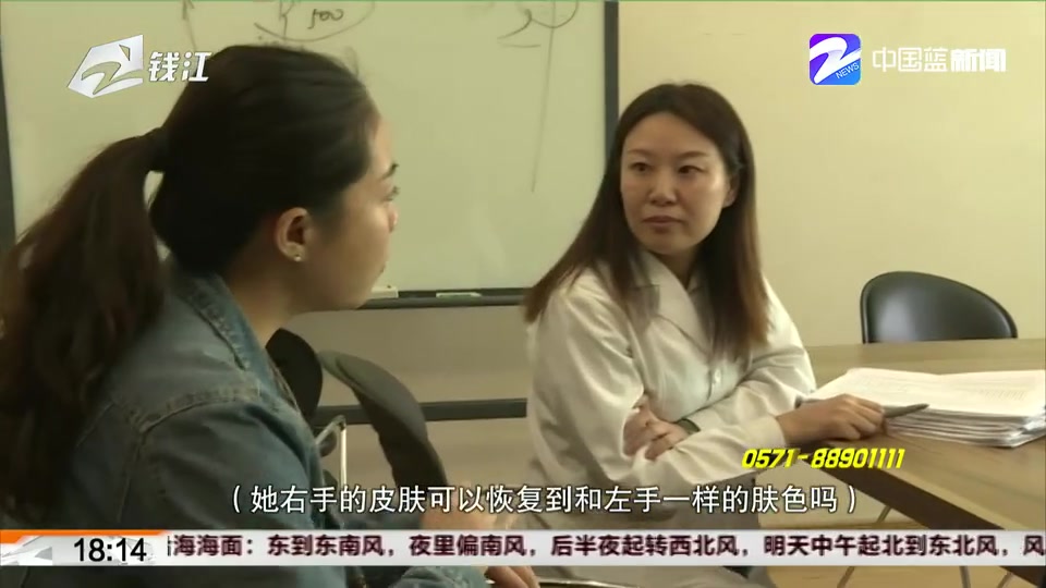 【浙江杭州】瑞丽医疗美容:激光去胎记治疗后 手上多了很多疤哔哩哔哩bilibili