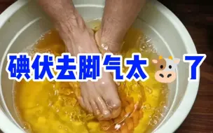 Download Video: 直接鬼了！碘伏去脚气脚癣真的太绝了！！都断根了