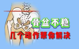 Descargar video: 出现骨盆不稳，几个动作帮你解决