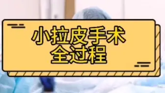 曝光了~脸部拉皮手术全过程，小拉皮手术全过程~zfr