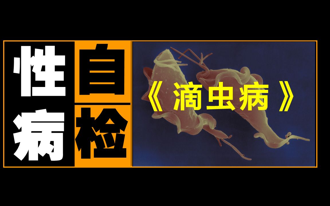 【性病科普】滴虫病,一种对女性极不友好的性病哔哩哔哩bilibili