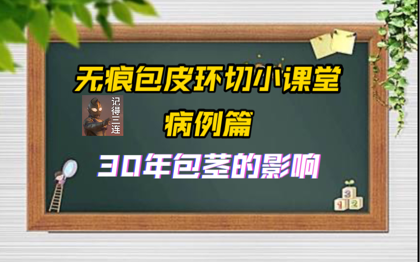 无痕包皮环切小课堂(3):病例篇——30年包茎的影响哔哩哔哩bilibili