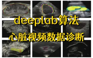 Download Video: 前沿研究丨深度学习在医学超声图像分析中的应用！基于deeplab的心脏视频数据诊断分析实战！人工智能/深度学习/神经网络/计算机视觉/机器学习算法