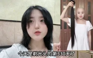 Tải video: 剃光头第330天了，还有一个月就一年了！