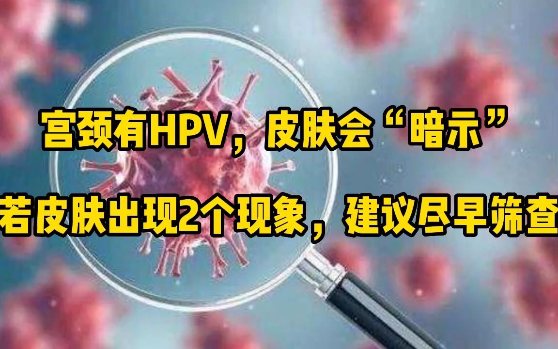 宫颈有HPV,皮肤会“暗示”,若皮肤出现2个现象,建议尽早筛查哔哩哔哩bilibili