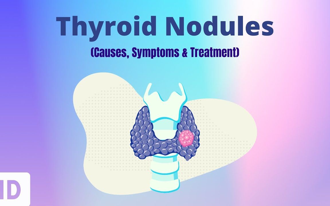 【医学双语视频】甲状腺结节 Thyroid Nodules 病因 症状 治疗方式 | 双语字幕 | 医学英语哔哩哔哩bilibili