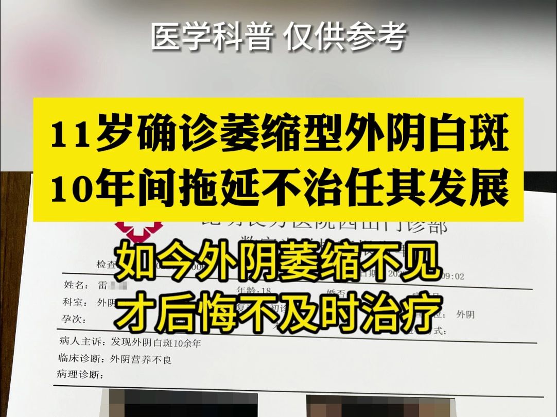 昆明良方外阴白斑研究中心地址21岁的她,已经有10年+的外阴白斑哔哩哔哩bilibili