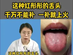 Download Video: 潘大夫舌诊：这种红彤彤的舌头，千万不能补，一补就会上火