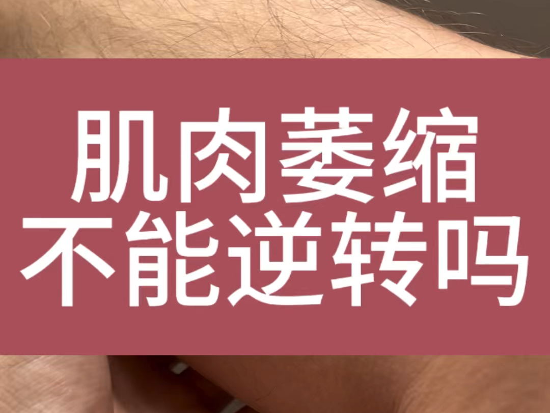 肌肉萎缩 不可逆转的情况几乎没有 除非神经坏死哔哩哔哩bilibili