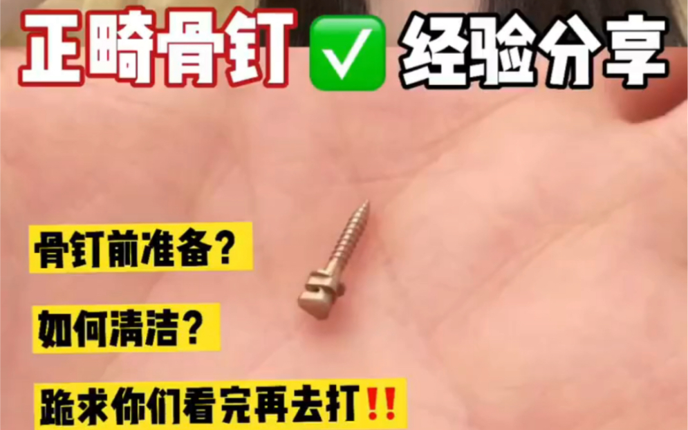 新手指南|正畸打骨钉超详细36615个注意事项