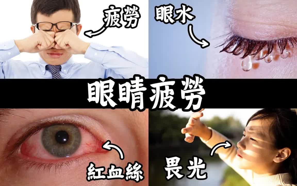 【简体中文字幕人工翻译】眼睛血丝,缺维他命B2,眼睛最重要的营养素 自然疗法,柏格医生dr berg哔哩哔哩bilibili