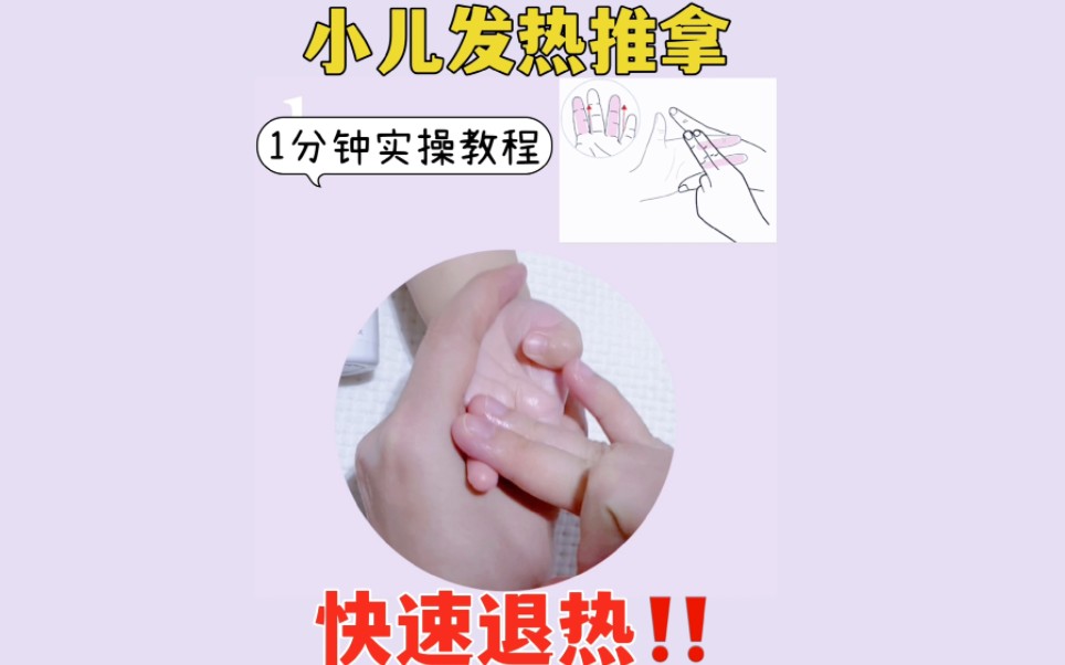 小儿发热推拿,1分钟实操教程,快速退热哔哩哔哩bilibili