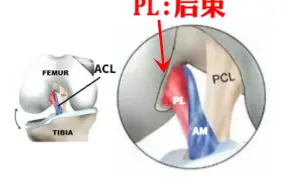 Download Video: 三步鉴别膝盖ACL问题