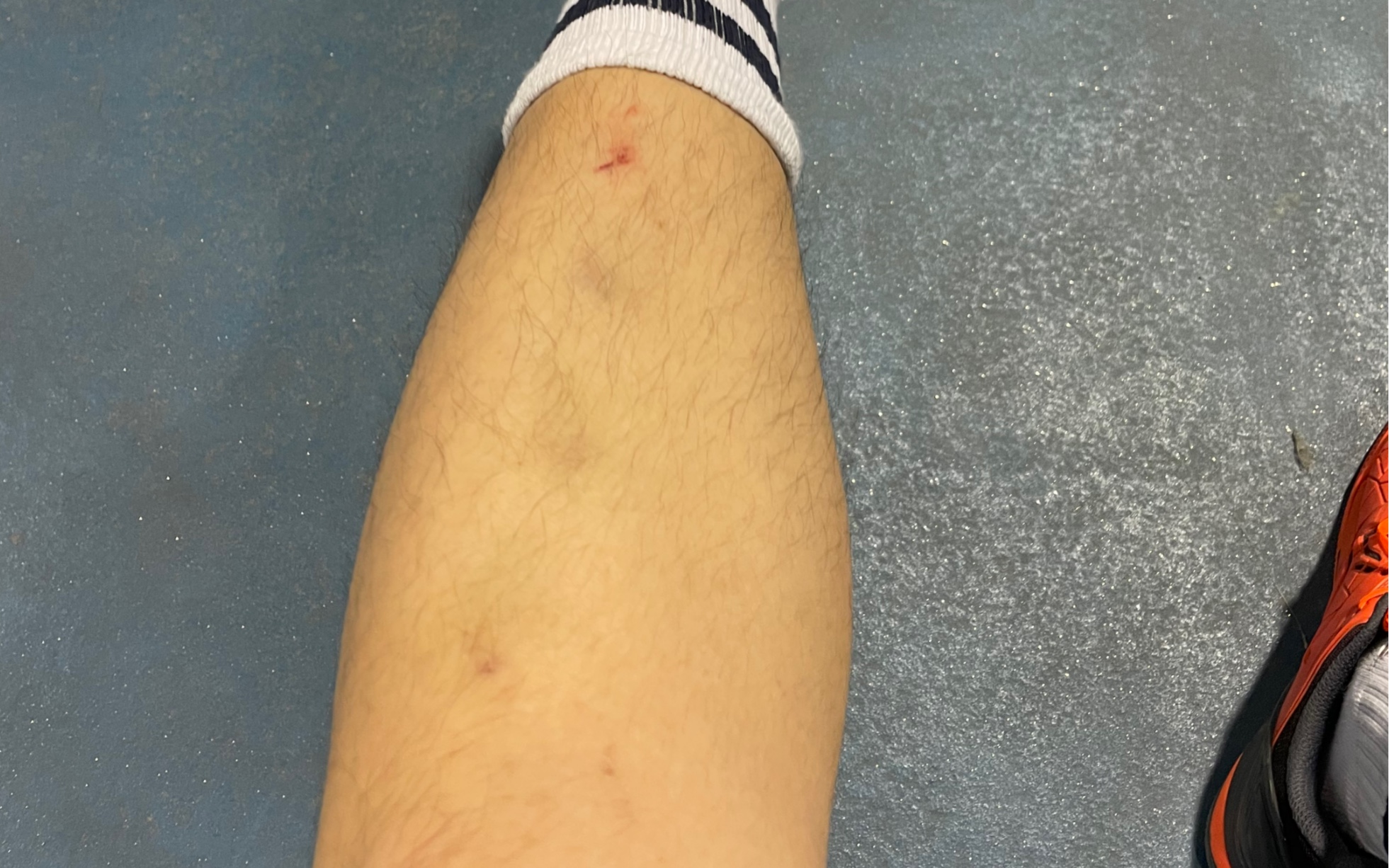 每周稳定给腿来一下,第几周废腿?