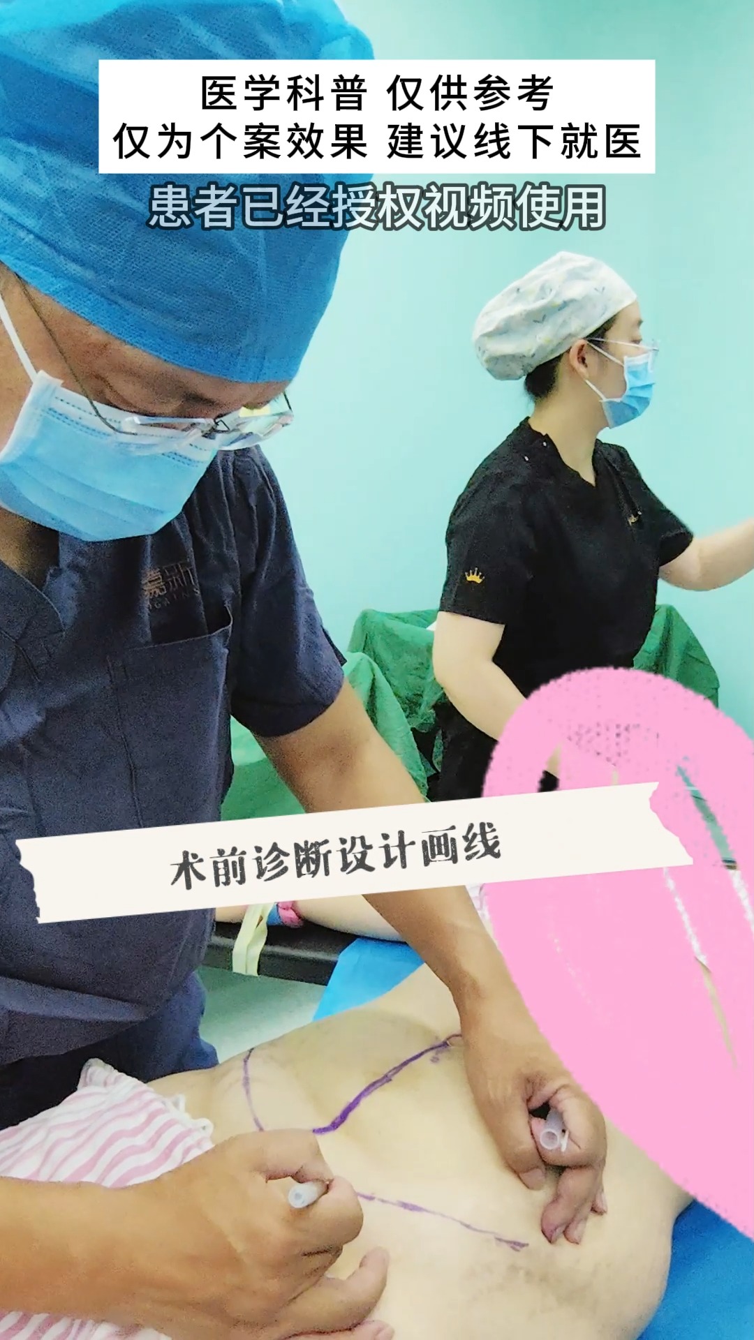 揭秘腹壁整形术全过程,还有哪些你不知道的事儿?