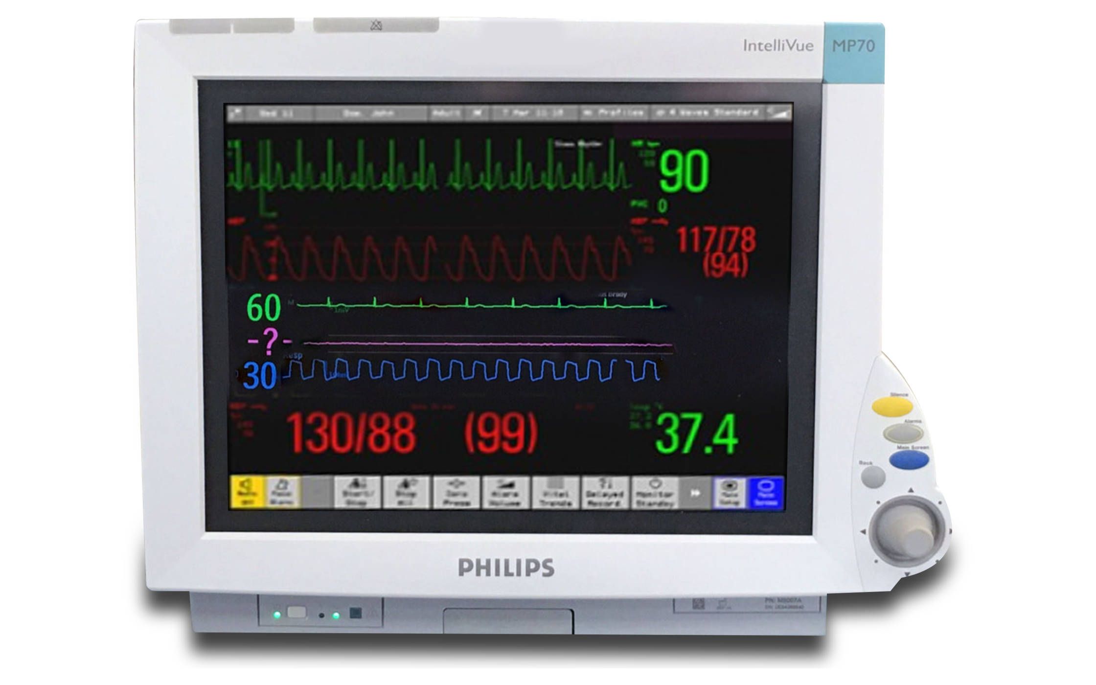 飞利浦 IntelliVue MP70 监护仪 警报哔哩哔哩bilibili