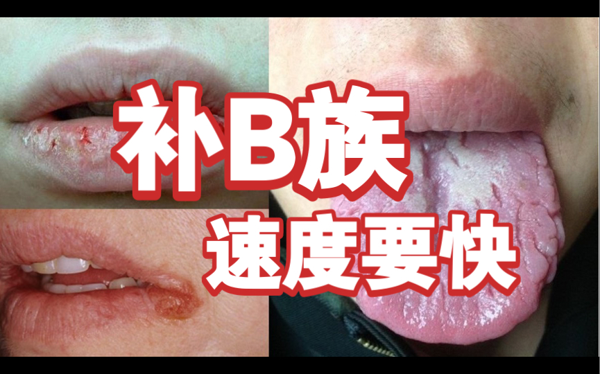 唇炎、口角炎、裂纹舌、阴囊炎!补B族!!!哔哩哔哩bilibili