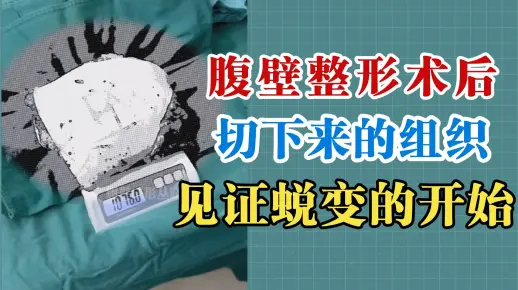 真实记录腹壁整形：切下来的组织，见证蜕变的开始✨