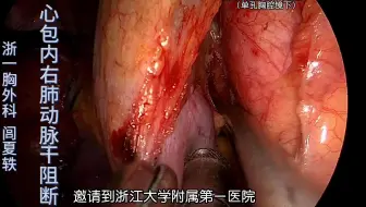 单孔胸腔镜 心包内右肺动脉干 阻断（解说版） 闾夏轶教授供稿