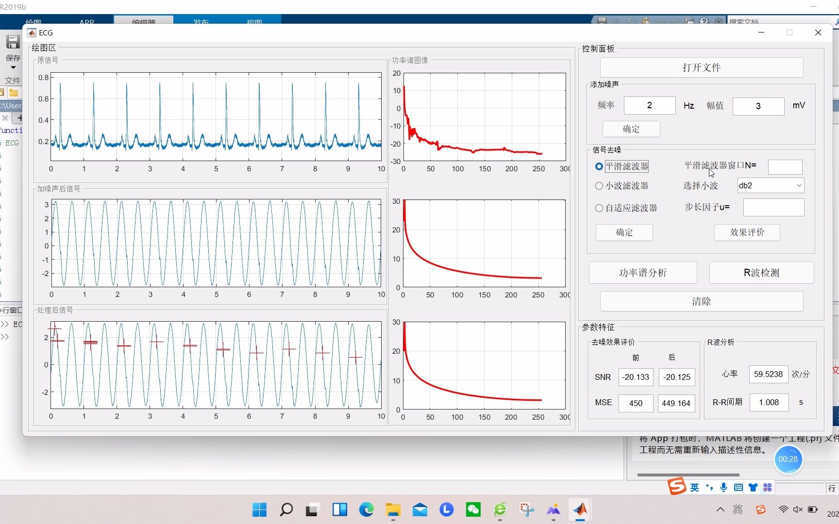 【心电信号】基于matlab GUI自适应滤波+平滑滤波+小波滤波心电信号处理【含Matlab源码 1809期】哔哩哔哩bilibili